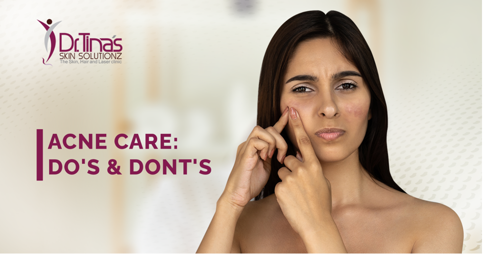 Acne Care Tip From Dr Tina Skin Solutionz