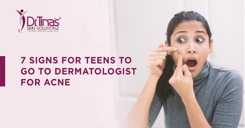 7 Signs for Teens to Go to Dermatologist for Acne