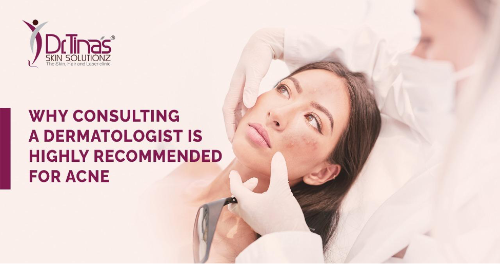 5 Reasons Why Consulting a Dermatologist is Highly Recommended For Acne Treatment