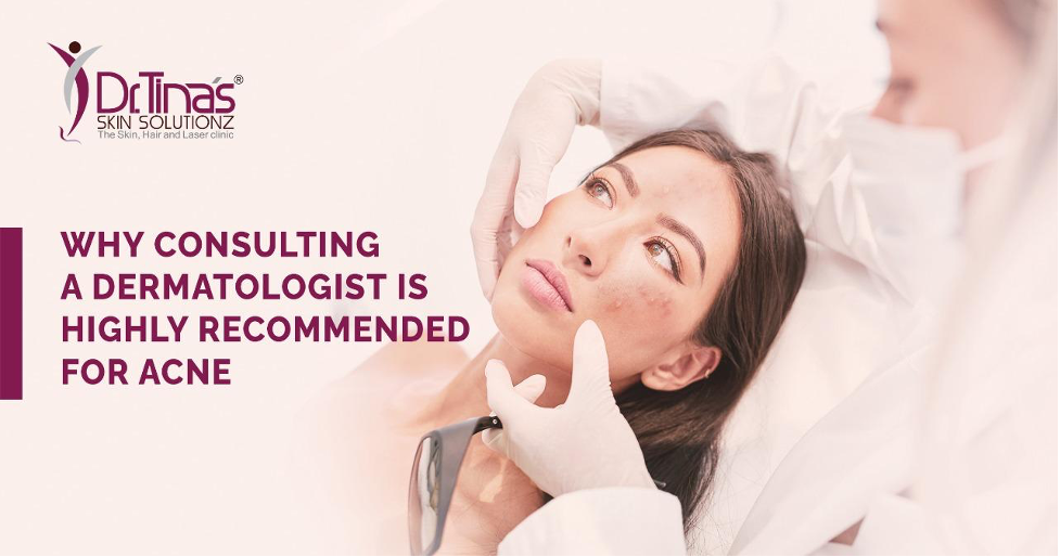 5 Reasons Why Consulting a Dermatologist is Highly Recommended For Acne Treatment 1 Acne Scar Treatment In Bangalore