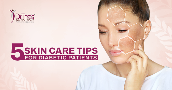5 Skin Care Tips for Diabetic Patients