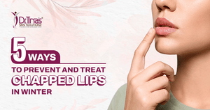 5 Ways to Prevent and Treat Chapped Lips in Winter