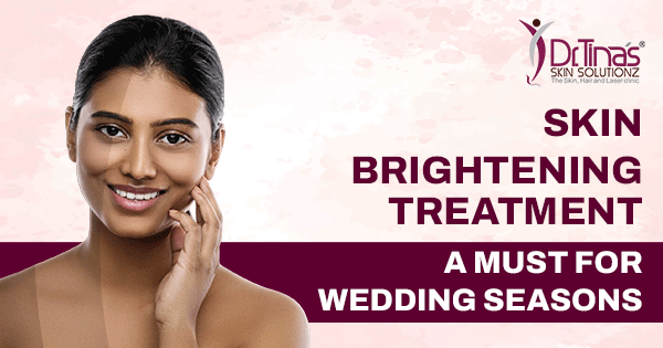 Skin Brightening Treatment- A Must for Wedding Seasons