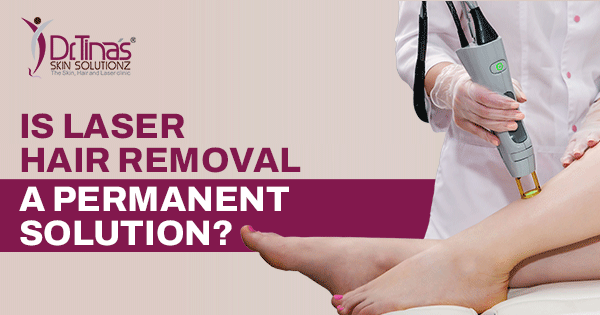 Is Laser Hair Removal a Permanent Solution 1
