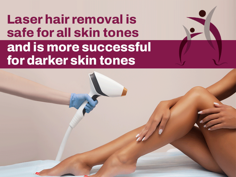 Laser Hair Removal Is Safe For All Skin Tones 
