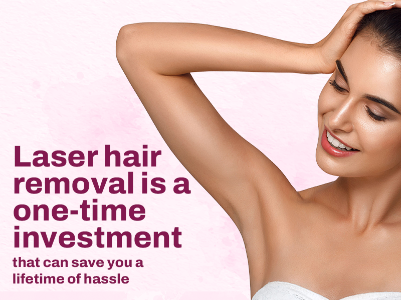 Laser hair removal is a one-time investment.
