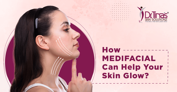 How Medifacials Helps with Skin Glow