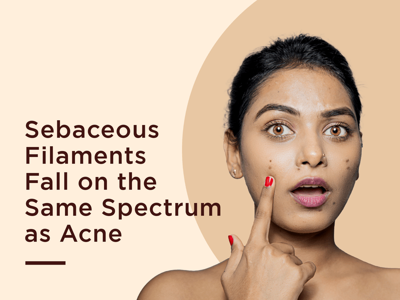 Sebaceous Filaments fall on the same spectrum as acne