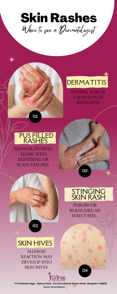 types of skin rashes 