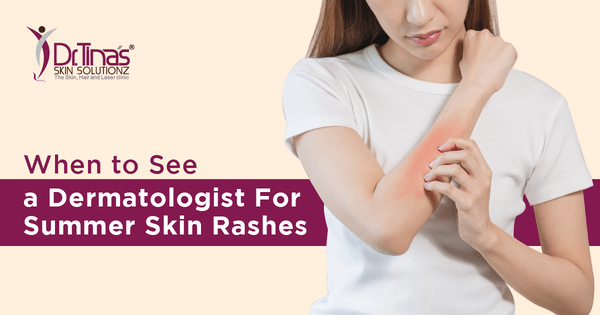When to See a Dermatologist for Your Summer Skin Rashes