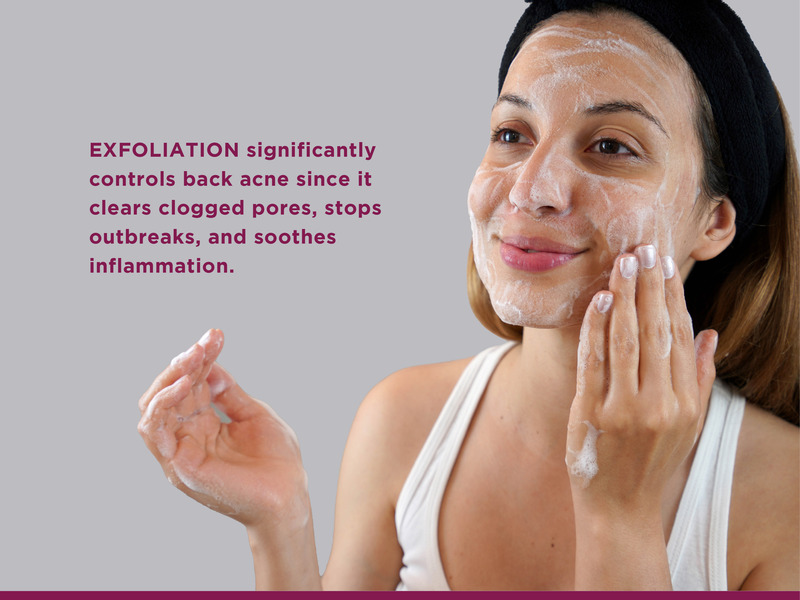 Exfoliation controls back acne 