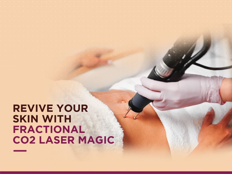 Revive your skin with fractional co2 laser treatment 