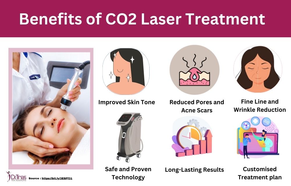 co2 laser treatment