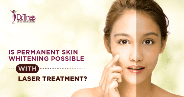 permanent skin whitening 