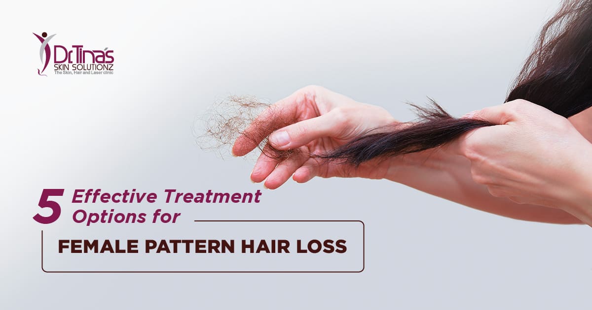5 Effective Treatment Options for Female Pattern Hair Loss