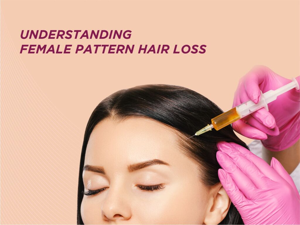 female pattern hair loss