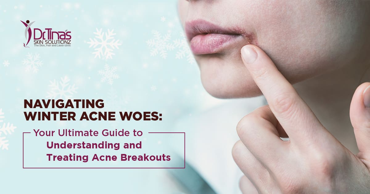 Why Do You Get Acne in Winter? The Ultimate Guide for Winter Acne Breakouts