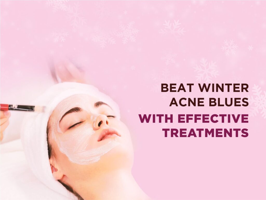 acne treatment