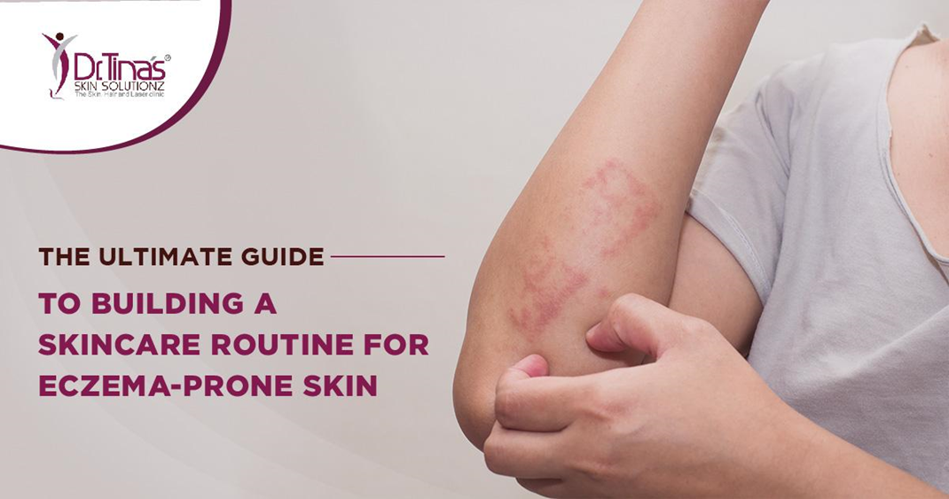 The Ultimate Guide to Building a Skincare Routine for Eczema-Prone Skin