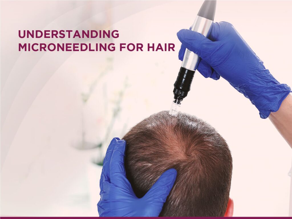 what is  micro-needling