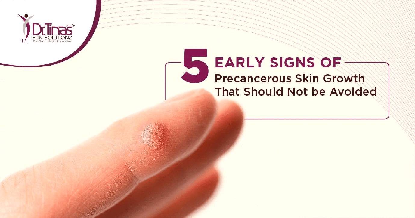 5 Early Signs of Precancerous Skin Growth That Should Not be Ignored