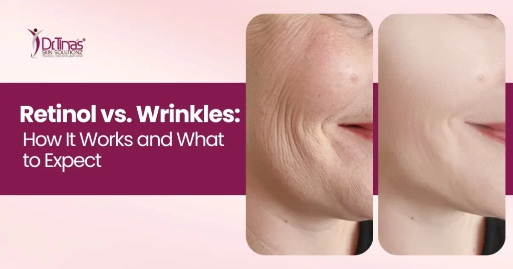 Retinol vs. Wrinkles: How It Works and What to Expect