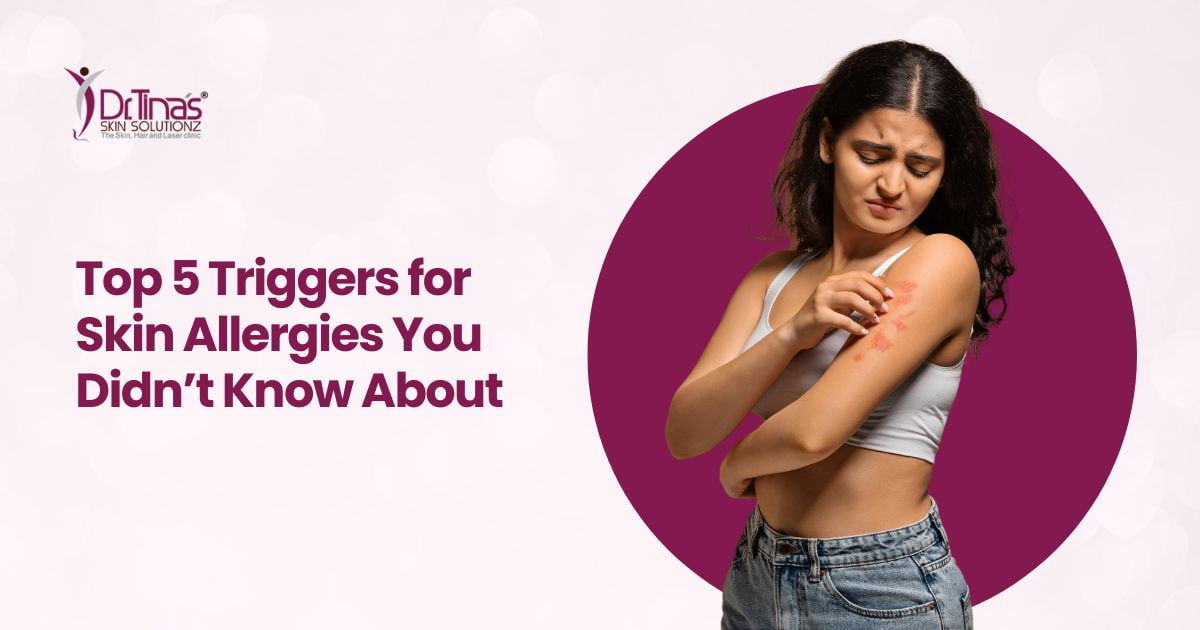 Top 5 Triggers for Skin Allergies You Didn’t Know About