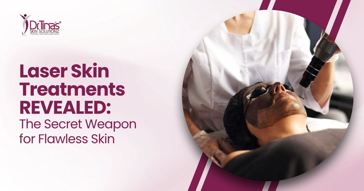 Laser Skin Treatments REVEALED: Your Secret Weapon for Clear, Confident Skin