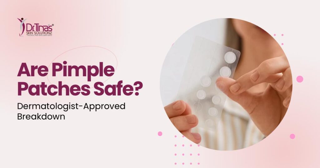 Are Pimple Patches Safe? A Dermatologist-Approved Breakdown