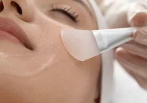 Chemical peels for melasma and pigmentation treatment