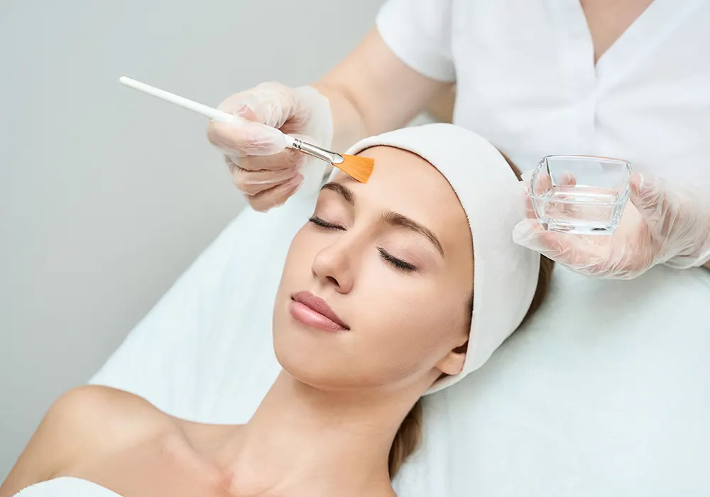 How does Chemical peel work