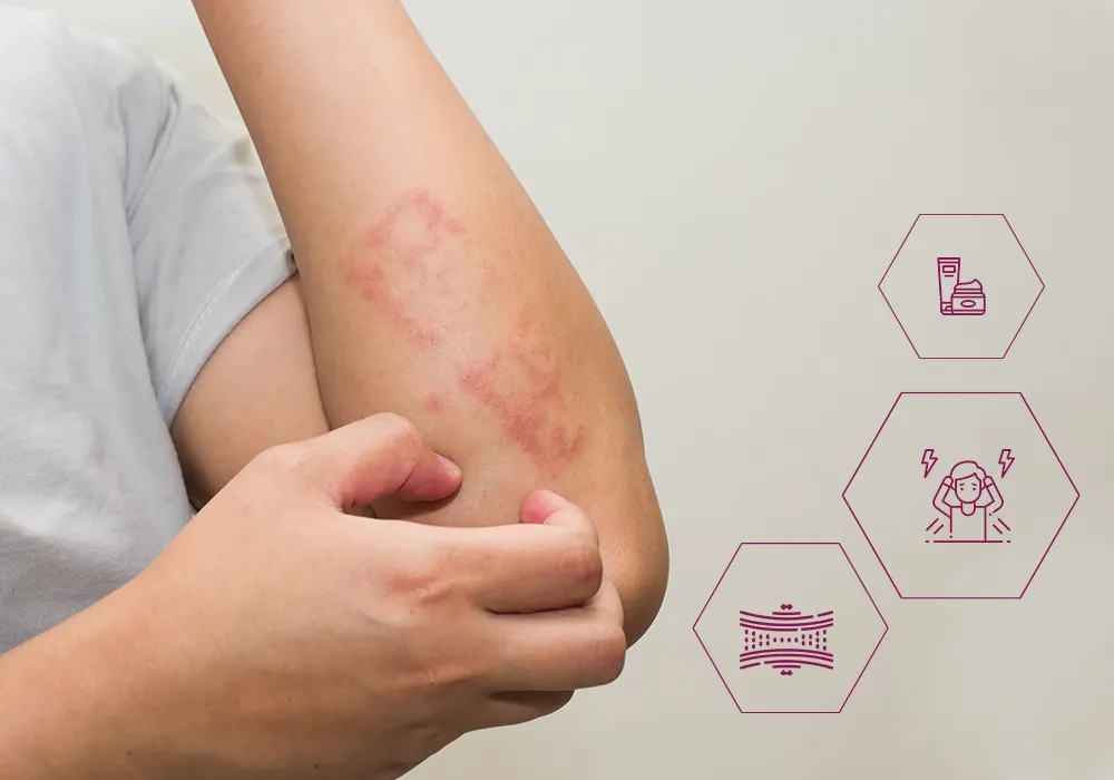 Causes of Skin allergy
